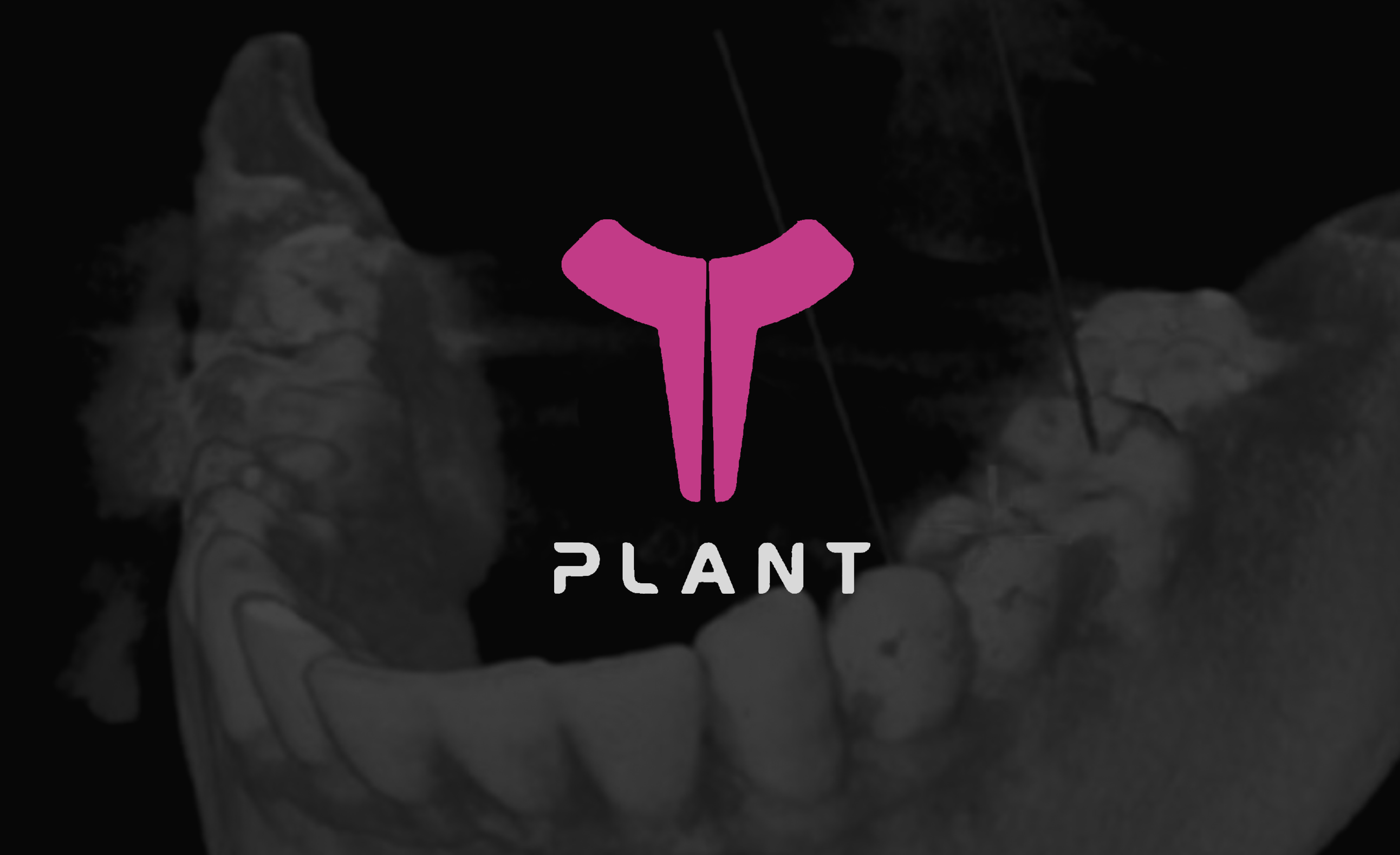 央山-医疗手机机器人设计