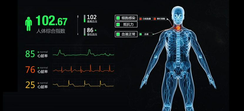 监控系统界面设计相关内容和监视系统界面设计设计流程